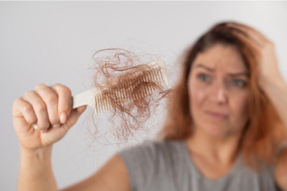 Which vitamin deficiency causes hair loss?
